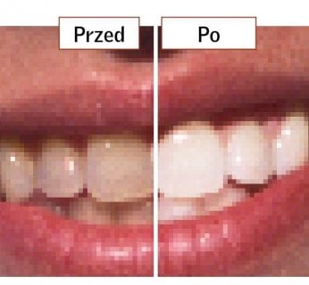 retusz zdjęć - Rozjaśnienie wybranych obszarów