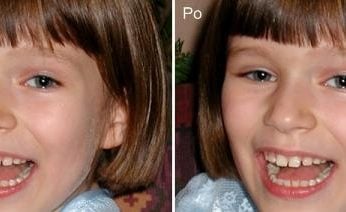 (fot. 10) Przed retuszem po prawej stronie na policzku światło tworzyło efekt szarości. Po retuszu mamy w tym miejscu uwydatnione rysy na policzkach.